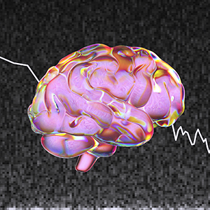 An illustration of a human brain against “pink noise” static.