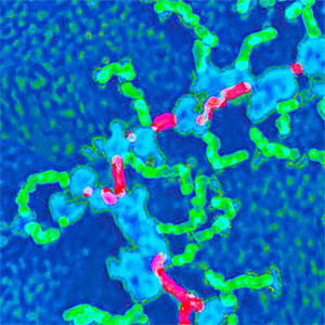 Colorized transmission electron micrograph of a polyribosome.