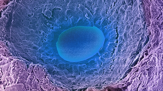 A colored scanning electron micrograph of a developing egg in an ovary follicle. The developing egg (oocyte) is a wide, flat oval sitting on a field of follicular cells.